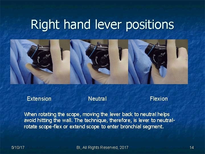 Right hand lever positions Extension Neutral Flexion When rotating the scope, moving the lever