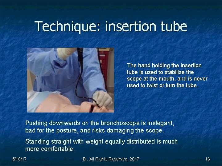 Technique: insertion tube The hand holding the insertion tube is used to stabilize the