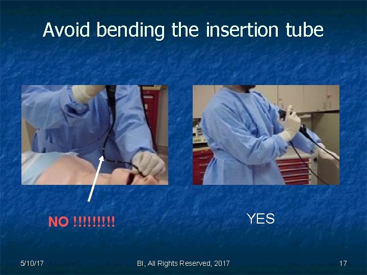 Avoid bending the insertion tube YES NO !!!!! 5/10/17 BI, All Rights Reserved, 2017