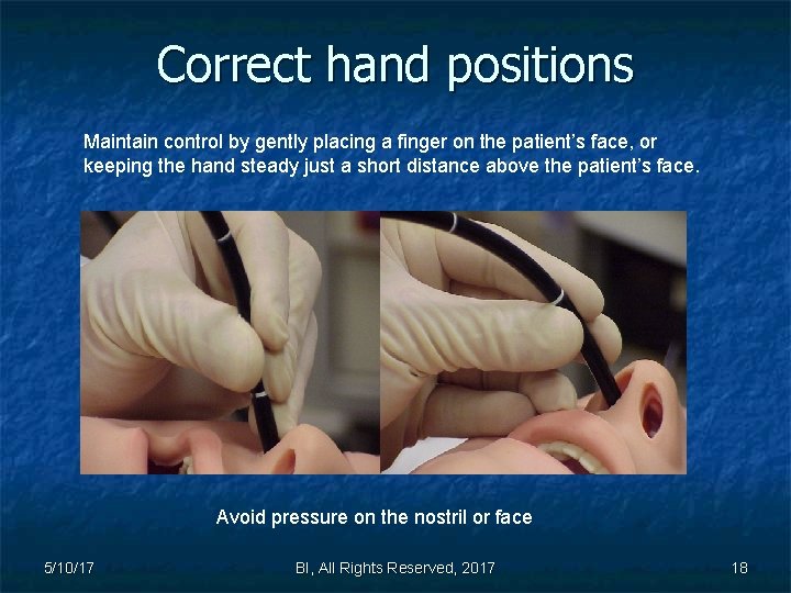 Correct hand positions Maintain control by gently placing a finger on the patient’s face,