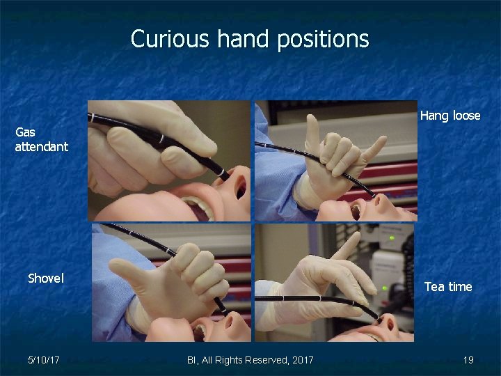 Curious hand positions Hang loose Gas attendant Shovel 5/10/17 Tea time BI, All Rights