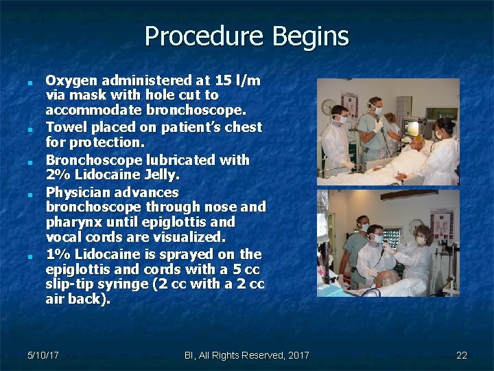Procedure Begins ■ ■ ■ Oxygen administered at 15 l/m via mask with hole