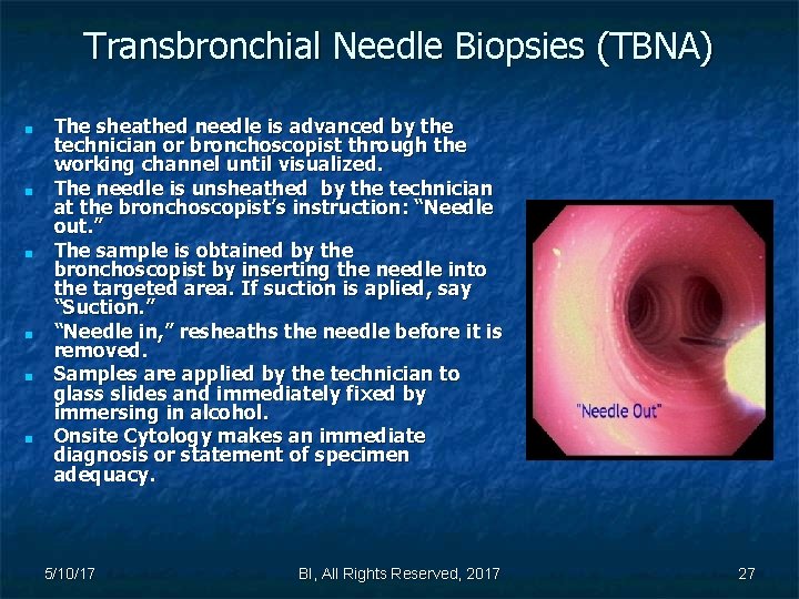 Transbronchial Needle Biopsies (TBNA) ■ ■ ■ The sheathed needle is advanced by the