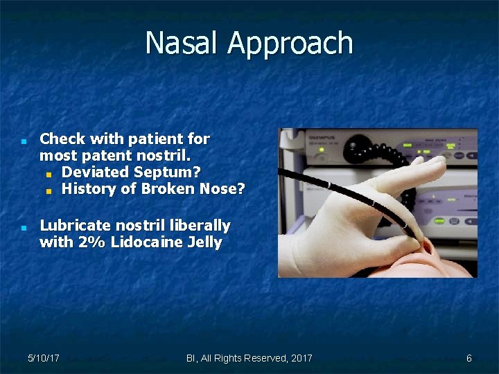 Nasal Approach ■ ■ Check with patient for most patent nostril. ■ Deviated Septum?