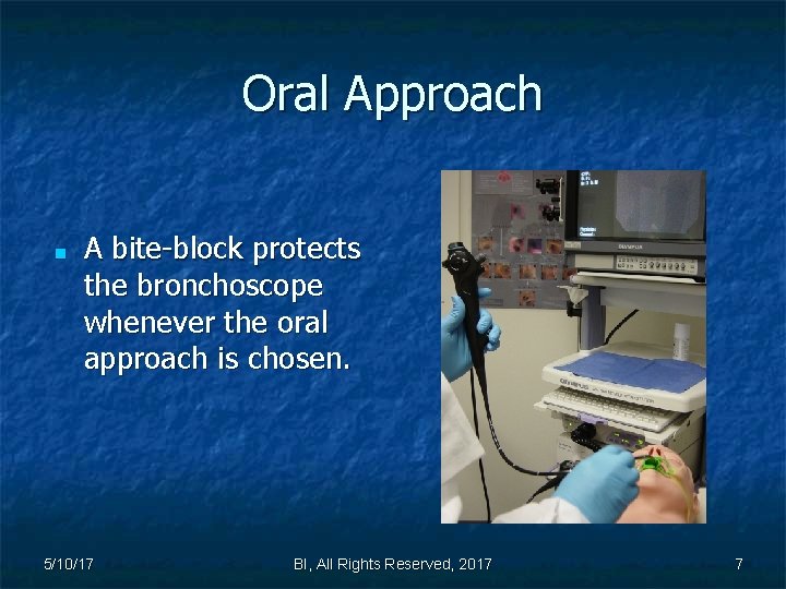 Oral Approach ■ A bite-block protects the bronchoscope whenever the oral approach is chosen.