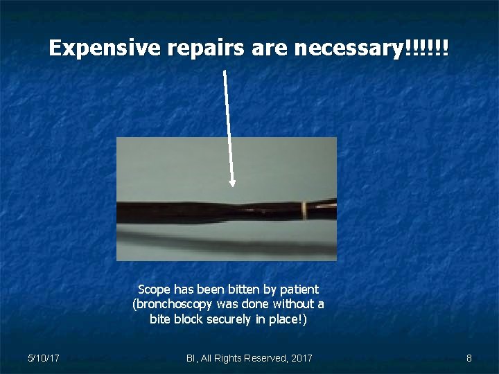 Expensive repairs are necessary!!!!!! Scope has been bitten by patient (bronchoscopy was done without