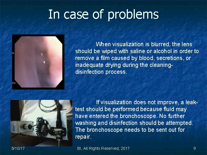 In case of problems When visualization is blurred, the lens should be wiped with