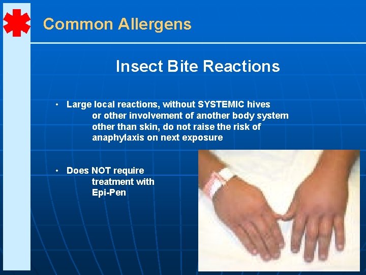 Common Allergens Insect Bite Reactions • Large local reactions, without SYSTEMIC hives or other