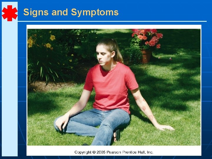 Signs and Symptoms 