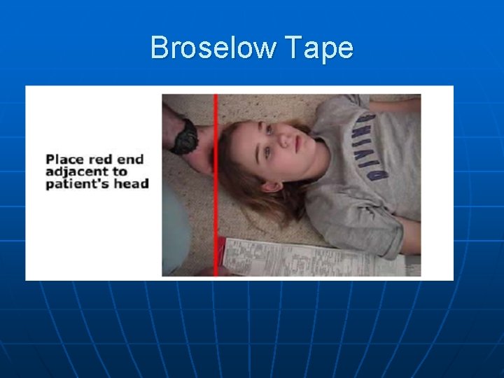 Broselow Tape 