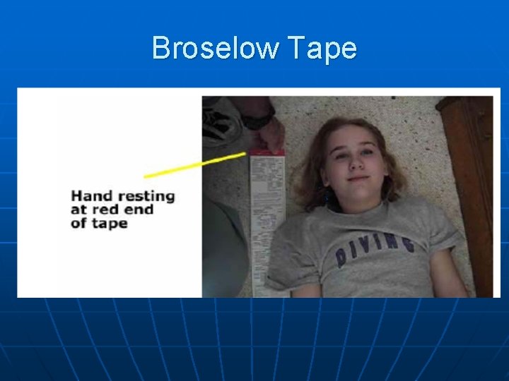 Broselow Tape 