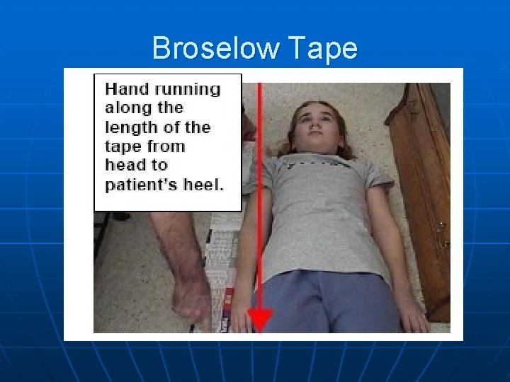 Broselow Tape 