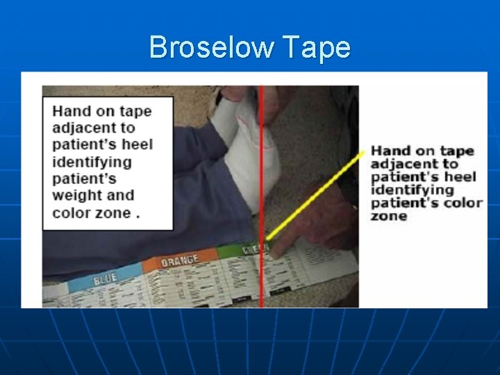 Broselow Tape 