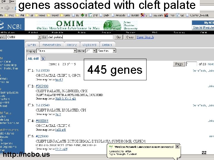 genes associated with cleft palate 445 genes http: //ncbo. us 22 