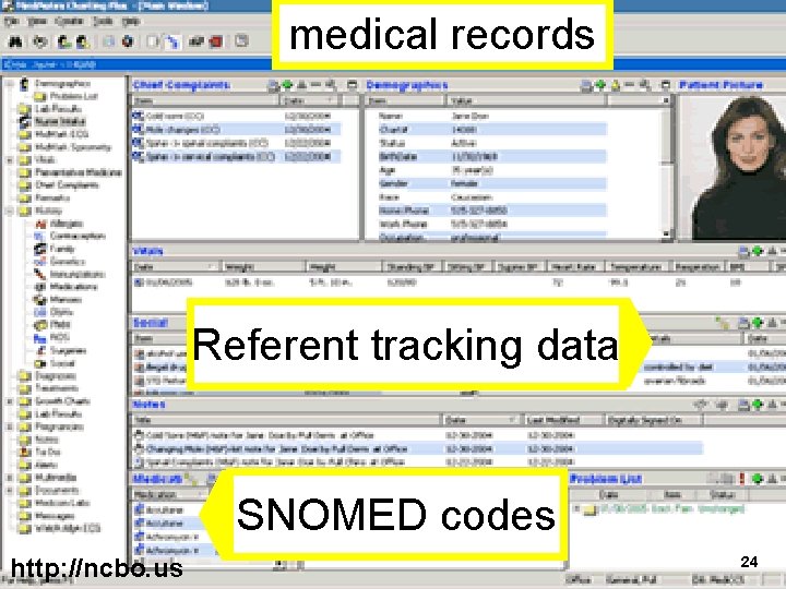 medical records Referent tracking data SNOMED codes http: //ncbo. us 24 