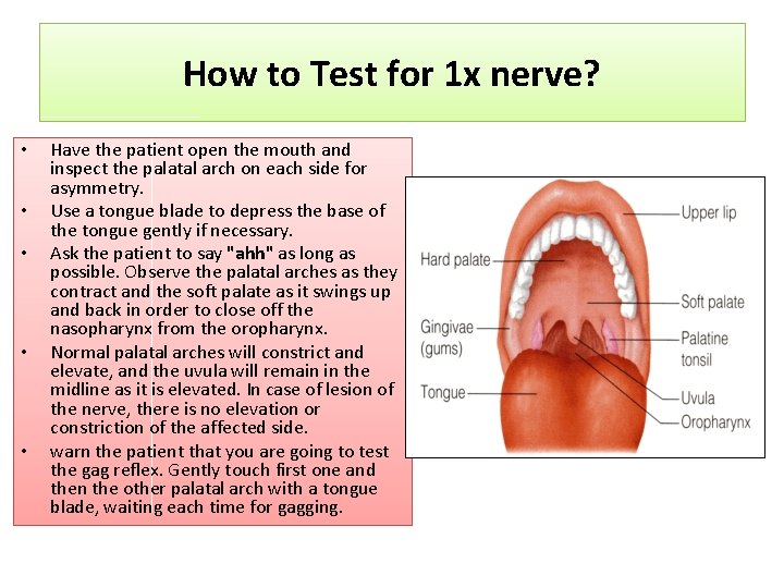 How to Test for 1 x nerve? • • • Have the patient open