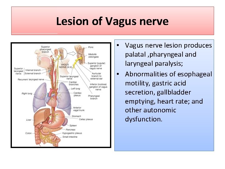 Lesion of Vagus nerve • Vagus nerve lesion produces palatal , pharyngeal and laryngeal