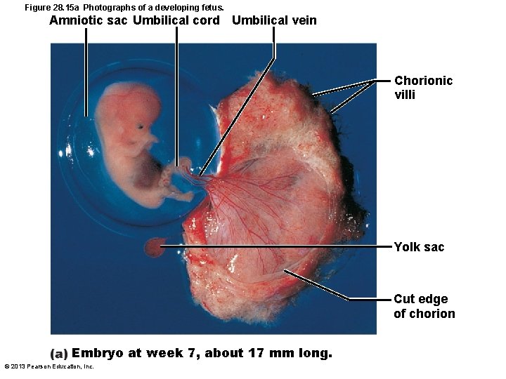 Figure 28. 15 a Photographs of a developing fetus. Amniotic sac Umbilical cord Umbilical