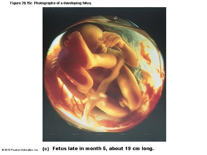 Figure 28. 15 c Photographs of a developing fetus. © 2013 Pearson Education, Inc.