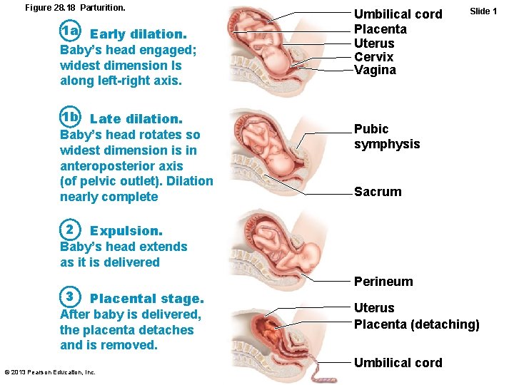 Figure 28. 18 Parturition. 1 a Early dilation. Baby’s head engaged; widest dimension Is