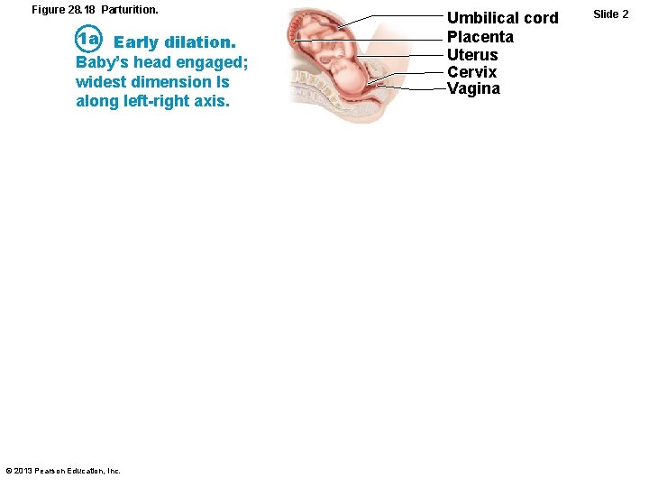 Figure 28. 18 Parturition. 1 a Early dilation. Baby’s head engaged; widest dimension Is