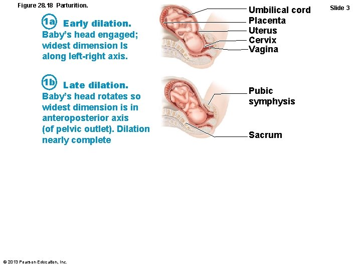 Figure 28. 18 Parturition. 1 a Early dilation. Baby’s head engaged; widest dimension Is