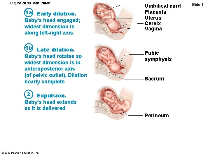 Figure 28. 18 Parturition. 1 a Early dilation. Baby’s head engaged; widest dimension Is