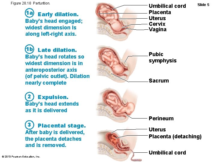 Figure 28. 18 Parturition. 1 a Early dilation. Baby’s head engaged; widest dimension Is