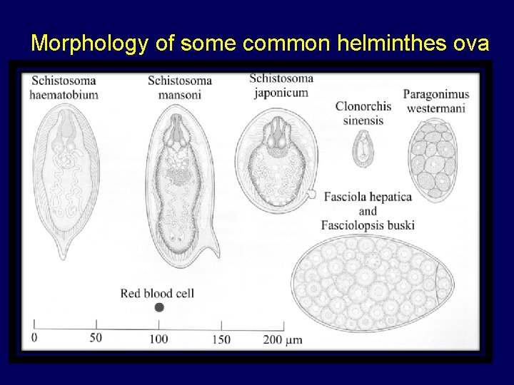  Morphology of some common helminthes ova 