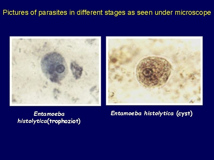 Pictures of parasites in different stages as seen under microscope Entamoeba histolytica(trophoziot) Entamoeba histolytica