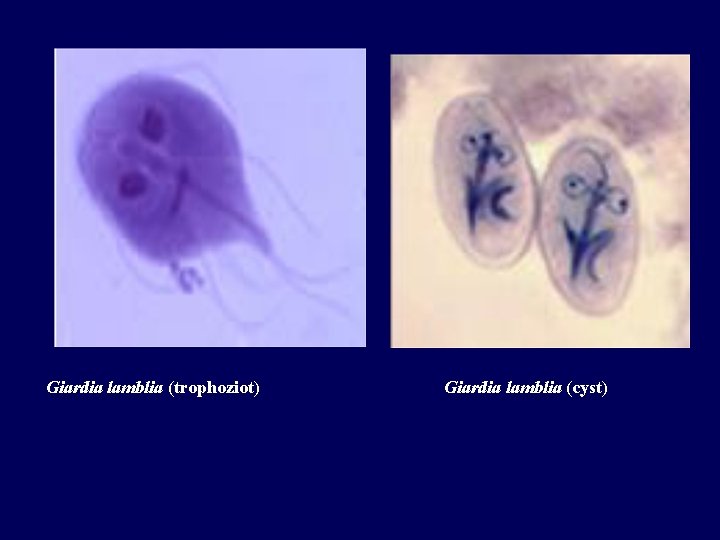 Giardia lamblia (trophoziot) Giardia lamblia (cyst) 