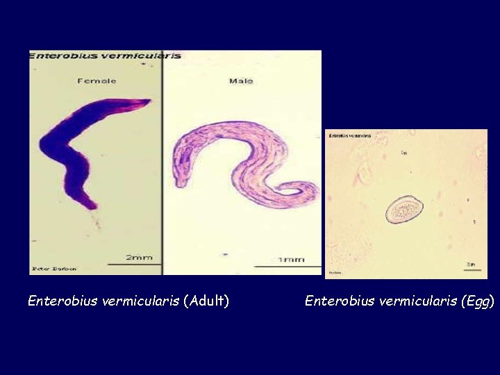Enterobius vermicularis (Adult) Enterobius vermicularis (Egg) 