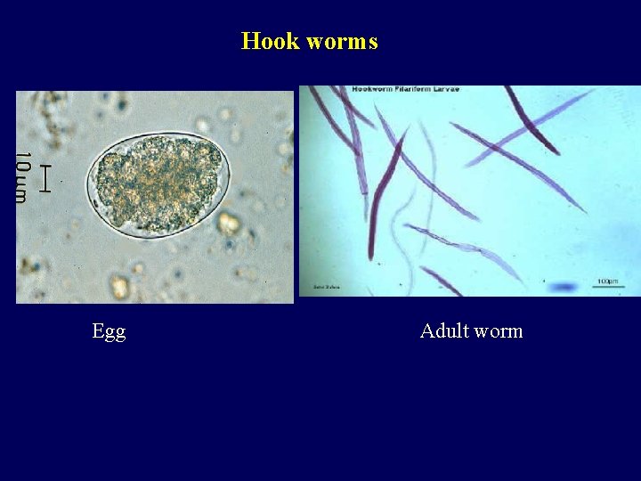 Hook worms Egg Adult worm 