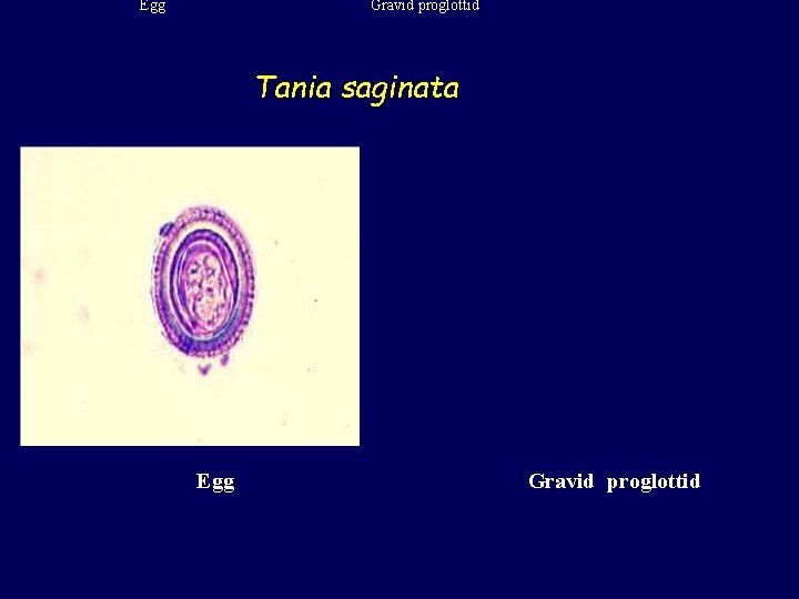 Egg Gravid proglottid Tania saginata Egg Gravid proglottid 