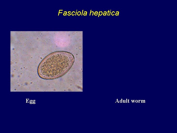  Fasciola hepatica Egg Adult worm 