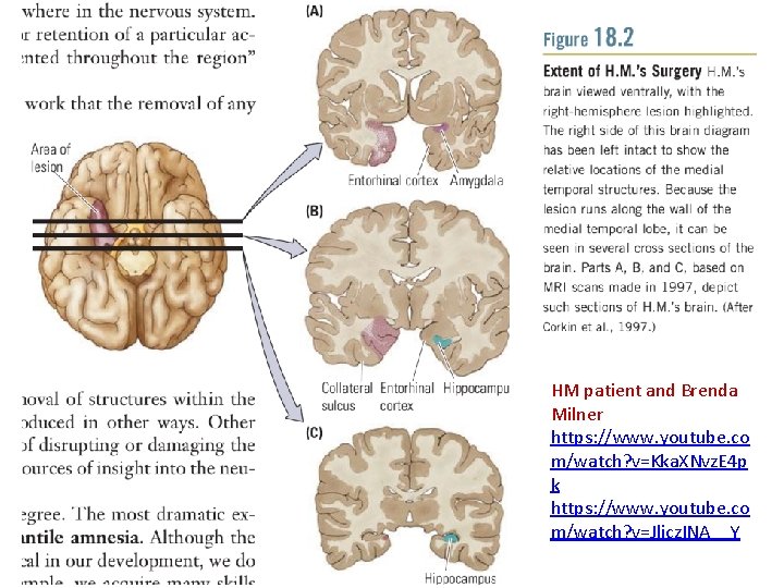HM patient and Brenda Milner https: //www. youtube. co m/watch? v=Kka. XNvz. E 4