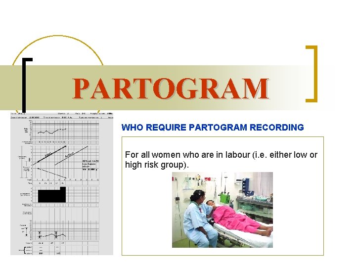 PARTOGRAM WHO REQUIRE PARTOGRAM RECORDING For all women who are in labour (i. e.