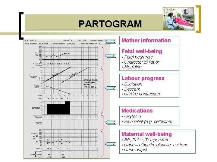 PARTOGRAM Mother information Fetal well-being • Fetal heart rate • Character of liquor •