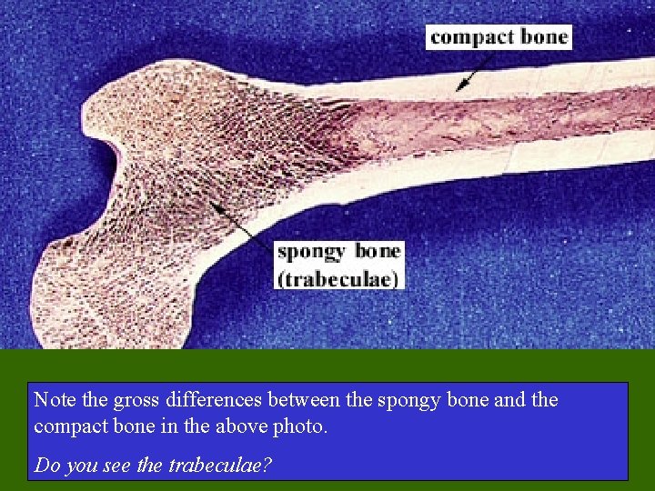 Note the gross differences between the spongy bone and the compact bone in the Note the gross differences between the spongy bone and the compact bone in the