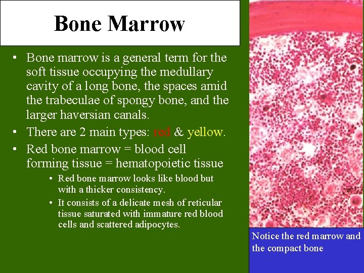 Bone Marrow • Bone marrow is a general term for the soft tissue occupying Bone Marrow • Bone marrow is a general term for the soft tissue occupying