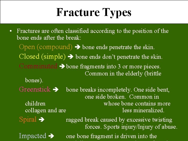 Fracture Types • Fractures are often classified according to the position of the bone Fracture Types • Fractures are often classified according to the position of the bone