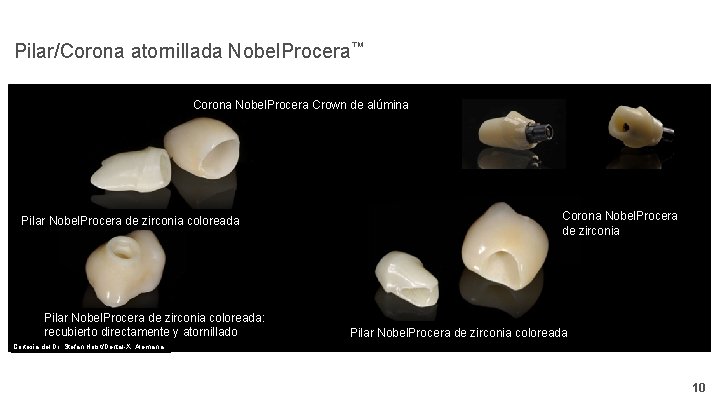Pilar/Corona atornillada Nobel. Procera™ Corona Nobel. Procera Crown de alúmina Pilar Nobel. Procera de