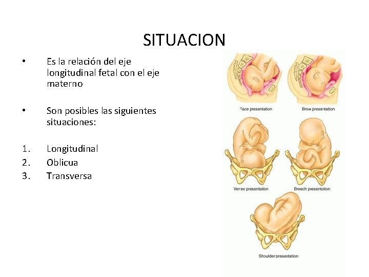 SITUACION • Es la relación del eje longitudinal fetal con el eje materno •