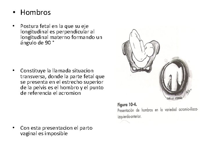  • Hombros • Postura fetal en la que su eje longitudinal es perpendicular