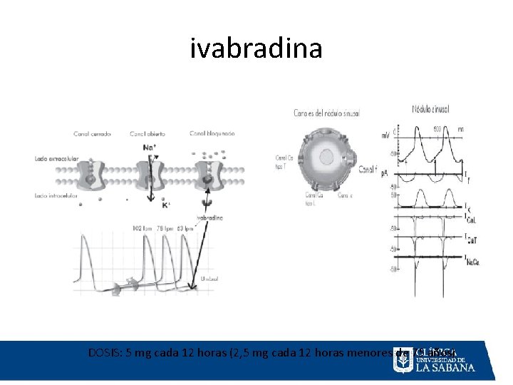 ivabradina DOSIS: 5 mg cada 12 horas (2, 5 mg cada 12 horas menores