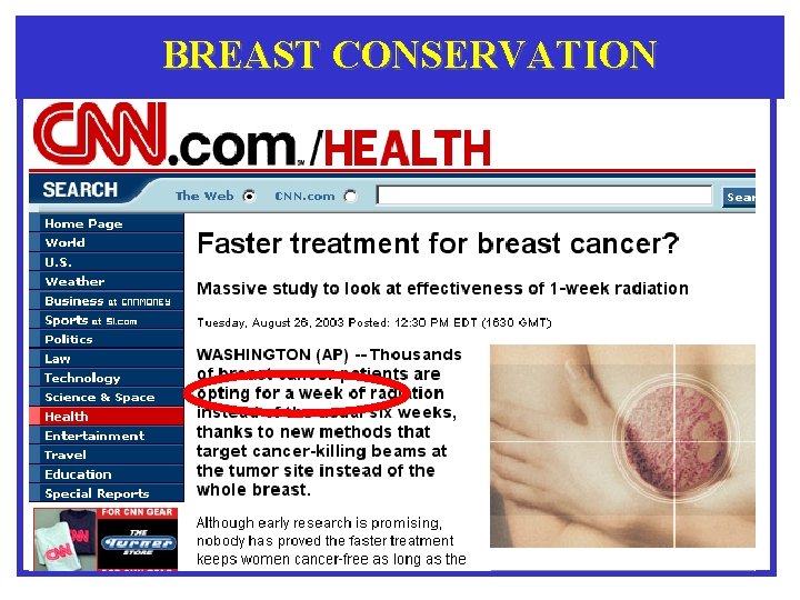 BREAST CONSERVATION 