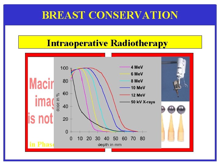 BREAST CONSERVATION Intraoperative Radiotherapy in Phase III 