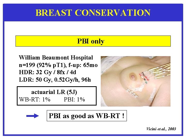 BREAST CONSERVATION PBI only William Beaumont Hospital n=199 (92% p. T 1), f-up: 65