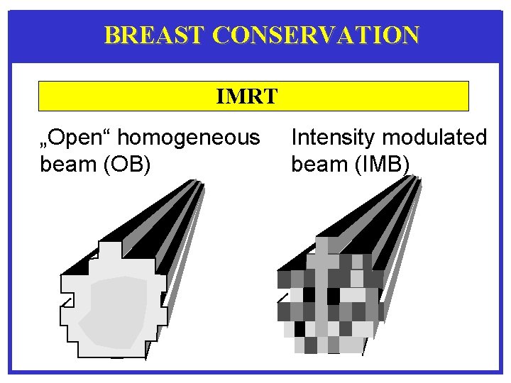 BREAST CONSERVATION IMRT „Open“ homogeneous beam (OB) Intensity modulated beam (IMB) 