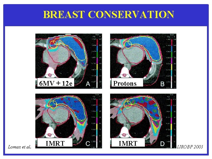 BREAST CONSERVATION 6 MV + 12 e Lomax et al. IMRT Protons IMRT IJROBP